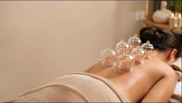 Cupping Therapy